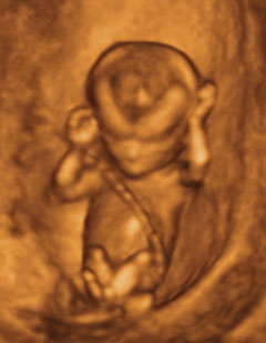13 week